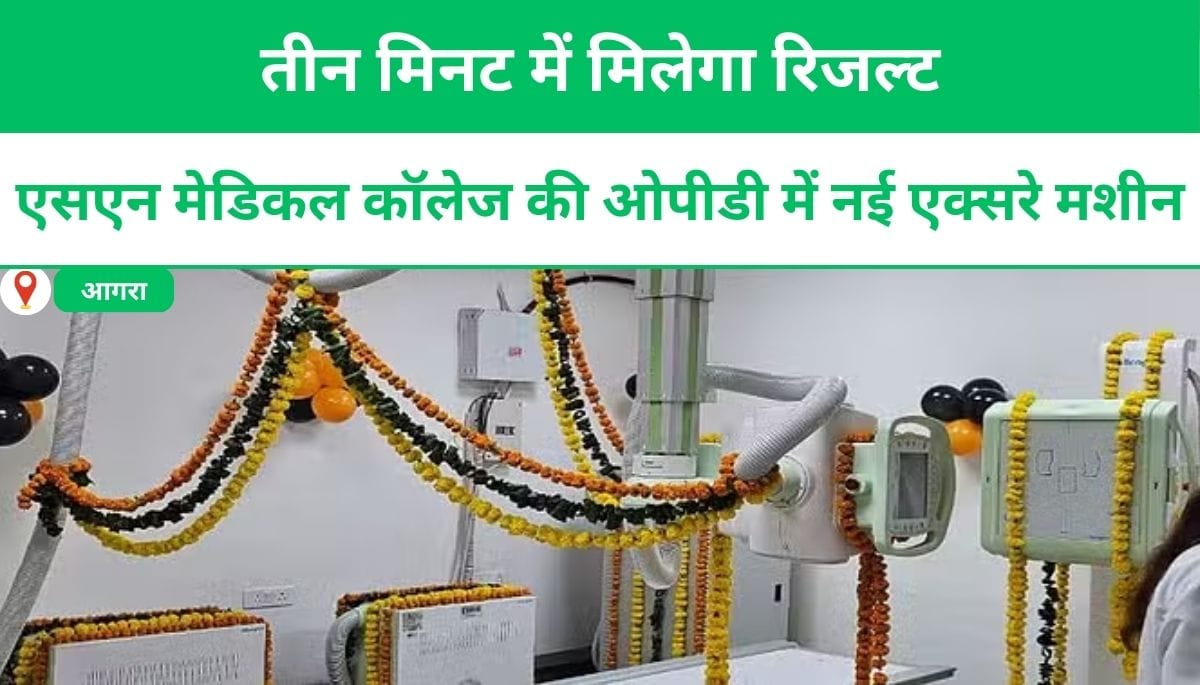 आगरा: एसएन मेडिकल कॉलेज की ओपीडी में नई एक्सरे मशीन, तीन मिनट में मिलेगा रिजल्ट